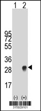 Western blot analysis of his-tag MS4A7 (arrow) using his tag antibody. 293T cell lysates (2 ug/lane) either nontransfected (Lane 1) or transiently transfected with the MS4A7 gene‘