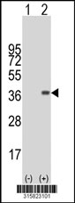 Western blot analysis of his-tag MS4A4A (arrow) using his tag antibody. 293T cell lysates (2 ug/lane) either nontransfected (Lane 1) or transiently transfected with the MS4A4A gene‘