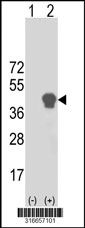 Western blot analysis of his-tag SEPT3 (arrow) using his tag antibody. 293T cell lysates (2 ug/lane) either nontransfected (Lane 1) or transiently transfected with the SEPT3 gene‘