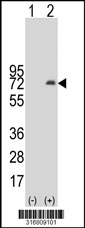 Western blot analysis of his-tag PATL1 (arrow) using his tag antibody. 293T cell lysates (2 ug/lane) either nontransfected (Lane 1) or transiently transfected with the PATL1 gene‘