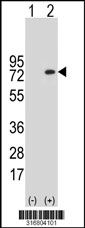 Western blot analysis of his-tag CCDC37 (arrow) using his tag antibody. 293T cell lysates (2 ug/lane) either nontransfected (Lane 1) or transiently transfected with the CCDC37 gene‘