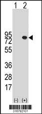 Western blot analysis of his-tag MPEG1 (arrow) using his tag antibody. 293T cell lysates (2 ug/lane) either nontransfected (Lane 1) or transiently transfected with the MPEG1 gene‘
