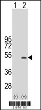 Western blot analysis of his-tag C9orf117 (arrow) using his tag antibody. 293T cell lysates (2 ug/lane) either nontransfected (Lane 1) or transiently transfected with the C9orf117 gene‘