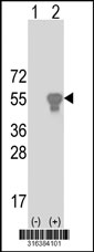 Western blot analysis of his-tag PSMC3 (arrow) using his tag antibody. 293T cell lysates (2 ug/lane) either nontransfected (Lane 1) or transiently transfected with the PSMC3 gene‘