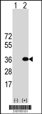 Western blot analysis of his-tag INCA1 (arrow) using his tag antibody. 293T cell lysates (2 ug/lane) either nontransfected (Lane 1) or transiently transfected with the INCA1 gene‘