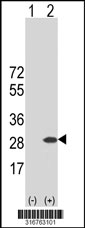 Western blot analysis of his-tag BAG2 (arrow) using his tag antibody. 293T cell lysates (2 ug/lane) either nontransfected (Lane 1) or transiently transfected with the BAG2 gene‘