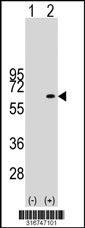 Western blot analysis of his-tag MATN4 (arrow) using his tag antibody. 293T cell lysates (2 ug/lane) either nontransfected (Lane 1) or transiently transfected with the MATN4 gene‘