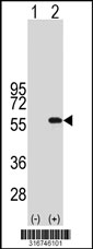Western blot analysis of his-tag TEKT5 (arrow) using his tag antibody. 293T cell lysates (2 ug/lane) either nontransfected (Lane 1) or transiently transfected with the TEKT5 gene‘