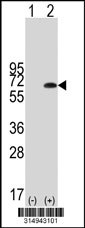 Western blot analysis of his-tag TBX22 (arrow) using his tag antibody. 293T cell lysates (2 ug/lane) either nontransfected (Lane 1) or transiently transfected with the TBX22 gene‘