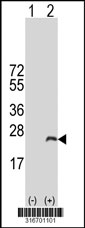 Western blot analysis of his-tag TNP2 (arrow) using his tag antibody. 293T cell lysates (2 ug/lane) either nontransfected (Lane 1) or transiently transfected with the TNP2 gene‘