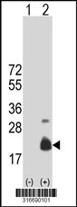 Western blot analysis of his-tag LOC57228 (arrow) using his tag antibody. 293T cell lysates (2 ug/lane) either nontransfected (Lane 1) or transiently transfected with the LOC57228 gene‘