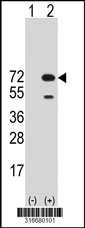 Western blot analysis of his-tag TOR1AIP2 (arrow) using his tag antibody. 293T cell lysates (2 ug/lane) either nontransfected (Lane 1) or transiently transfected with the TOR1AIP2 gene‘