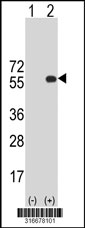 Western blot analysis of his-tag B3GNT6 (arrow) using his tag antibody. 293T cell lysates (2 ug/lane) either nontransfected (Lane 1) or transiently transfected with the B3GNT6 gene‘