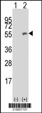 Western blot analysis of his-tag HTR3C (arrow) using his tag antibody. 293T cell lysates (2 ug/lane) either nontransfected (Lane 1) or transiently transfected with the HTR3C gene‘