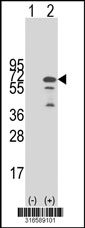Western blot analysis of his-tag GBP6 (arrow) using his tag antibody. 293T cell lysates (2 ug/lane) either nontransfected (Lane 1) or transiently transfected with the GBP6 gene‘