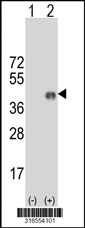Western blot analysis of his-tag FAM133A (arrow) using his tag antibody. 293T cell lysates (2 ug/lane) either nontransfected (Lane 1) or transiently transfected with the FAM133A gene‘