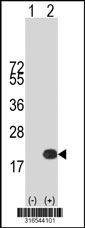Western blot analysis of his-tag C4orf46 (arrow) using his tag antibody. 293T cell lysates (2 ug/lane) either nontransfected (Lane 1) or transiently transfected with the C4orf46 gene‘