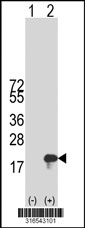 Western blot analysis of his-tag FAM101A (arrow) using his tag antibody. 293T cell lysates (2 ug/lane) either nontransfected (Lane 1) or transiently transfected with the FAM101A gene‘