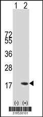 Western blot analysis of his-tag COX19 (arrow) using his tag antibody. 293T cell lysates (2 ug/lane) either nontransfected (Lane 1) or transiently transfected with the COX19 gene‘