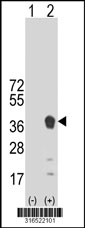 Western blot analysis of his-tag C12orf68 (arrow) using his tag antibody. 293T cell lysates (2 ug/lane) either nontransfected (Lane 1) or transiently transfected with the C12orf68 gene‘