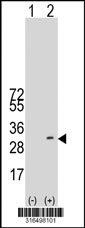 Western blot analysis of his-tag RAB5B (arrow) using his tag antibody. 293T cell lysates (2 ug/lane) either nontransfected (Lane 1) or transiently transfected with the RAB5B gene‘
