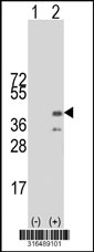 Western blot analysis of his-tag FAM102B (arrow) using his tag antibody. 293T cell lysates (2 ug/lane) either nontransfected (Lane 1) or transiently transfected with the FAM102B gene‘