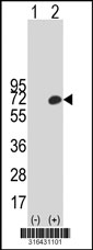 Western blot analysis of his-tag SMYD1 (arrow) using his tag antibody. 293T cell lysates (2 ug/lane) either nontransfected (Lane 1) or transiently transfected with the SMYD1 gene‘