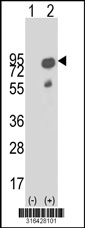 Western blot analysis of his-tag LIMD1 (arrow) using his tag antibody. 293T cell lysates (2 ug/lane) either nontransfected (Lane 1) or transiently transfected with the LIMD1 gene‘