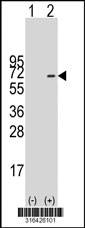Western blot analysis of his-tag TSNARE1 (arrow) using his tag antibody. 293T cell lysates (2 ug/lane) either nontransfected (Lane 1) or transiently transfected with the TSNARE1 gene‘