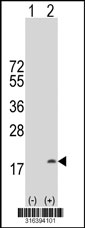Western blot analysis of his-tag FLJ45537 (arrow) using his tag antibody. 293T cell lysates (2 ug/lane) either nontransfected (Lane 1) or transiently transfected with the FLJ45537 gene‘