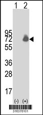 Western blot analysis of his-tag SYN3 (arrow) using his tag antibody. 293T cell lysates (2 ug/lane) either nontransfected (Lane 1) or transiently transfected with the SYN3 gene‘