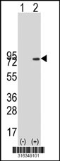 Western blot analysis of his-tag CCDC96 (arrow) using his tag antibody. 293T cell lysates (2 ug/lane) either nontransfected (Lane 1) or transiently transfected with the CCDC96 gene‘
