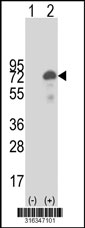 Western blot analysis of his-tag RBM47 (arrow) using his tag antibody. 293T cell lysates (2 ug/lane) either nontransfected (Lane 1) or transiently transfected with the RBM47 gene‘