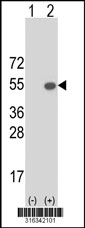 Western blot analysis of his-tag DPEP2 (arrow) using his tag antibody. 293T cell lysates (2 ug/lane) either nontransfected (Lane 1) or transiently transfected with the DPEP2 gene‘
