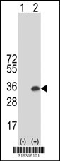 Western blot analysis of his-tag CCDC25 (arrow) using his tag antibody. 293T cell lysates (2 ug/lane) either nontransfected (Lane 1) or transiently transfected with the CCDC25 gene‘