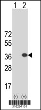 Western blot analysis of his-tag C1orf111 (arrow) using his tag antibody. 293T cell lysates (2 ug/lane) either nontransfected (Lane 1) or transiently transfected with the C1orf111 gene‘