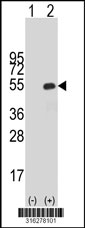 Western blot analysis of his-tag CCDC84 (arrow) using his tag antibody. 293T cell lysates (2 ug/lane) either nontransfected (Lane 1) or transiently transfected with the CCDC84 gene‘