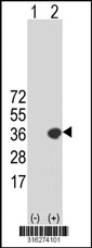 Western blot analysis of his-tag PECR (arrow) using his tag antibody. 293T cell lysates (2 ug/lane) either nontransfected (Lane 1) or transiently transfected with the PECR gene‘