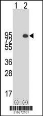 Western blot analysis of his-tag BUD13 (arrow) using his tag antibody. 293T cell lysates (2 ug/lane) either nontransfected (Lane 1) or transiently transfected with the BUD13 gene‘