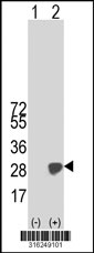 Western blot analysis of his-tag C4orf33 (arrow) using his tag antibody. 293T cell lysates (2 ug/lane) either nontransfected (Lane 1) or transiently transfected with the C4orf33 gene‘
