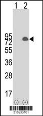Western blot analysis of his-tag TIGD4 (arrow) using his tag antibody. 293T cell lysates (2 ug/lane) either nontransfected (Lane 1) or transiently transfected with the TIGD4 gene‘