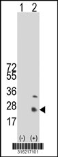Western blot analysis of his-tag SSX1 (arrow) using his tag antibody. 293T cell lysates (2 ug/lane) either nontransfected (Lane 1) or transiently transfected with the SSX1 gene‘