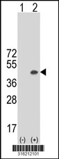 Western blot analysis of his-tag LOC652968 (arrow) using his tag antibody. 293T cell lysates (2 ug/lane) either nontransfected (Lane 1) or transiently transfected with the LOC652968 gene‘