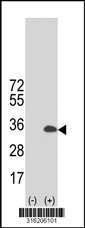 Western blot analysis of his-tag RDH13 (arrow) using his tag antibody. 293T cell lysates (2 ug/lane) either nontransfected (Lane 1) or transiently transfected with the RDH13 gene‘