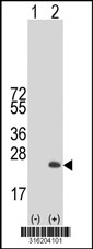 Western blot analysis of his-tag MYLPF (arrow) using his tag antibody. 293T cell lysates (2 ug/lane) either nontransfected (Lane 1) or transiently transfected with the MYLPF gene‘