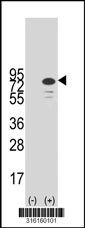 Western blot analysis of his-tag CHGA (arrow) using his tag antibody. 293T cell lysates (2 ug/lane) either nontransfected (Lane 1) or transiently transfected with the CHGA gene‘