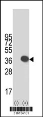 Western blot analysis of his-tag GGPS1 (arrow) using his tag antibody. 293T cell lysates (2 ug/lane) either nontransfected (Lane 1) or transiently transfected with the GGPS1 gene‘