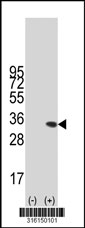 Western blot analysis of his-tag OXNAD1 (arrow) using his tag antibody. 293T cell lysates (2 ug/lane) either nontransfected (Lane 1) or transiently transfected with the OXNAD1 gene‘