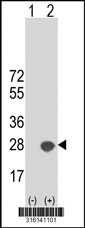 Western blot analysis of his-tag CRYGN (arrow) using his tag antibody. 293T cell lysates (2 ug/lane) either nontransfected (Lane 1) or transiently transfected with the CRYGN gene‘