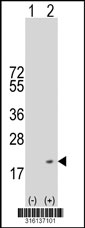Western blot analysis of his-tag NRN1L (arrow) using his tag antibody. 293T cell lysates (2 ug/lane) either nontransfected (Lane 1) or transiently transfected with the NRN1L gene‘